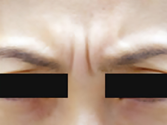 b_03.jpg